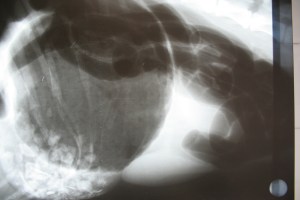 torsión de estómago